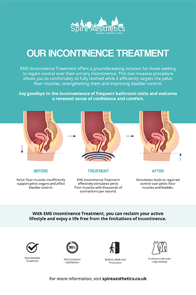 image of how urge incontinence Birkdale treatment works